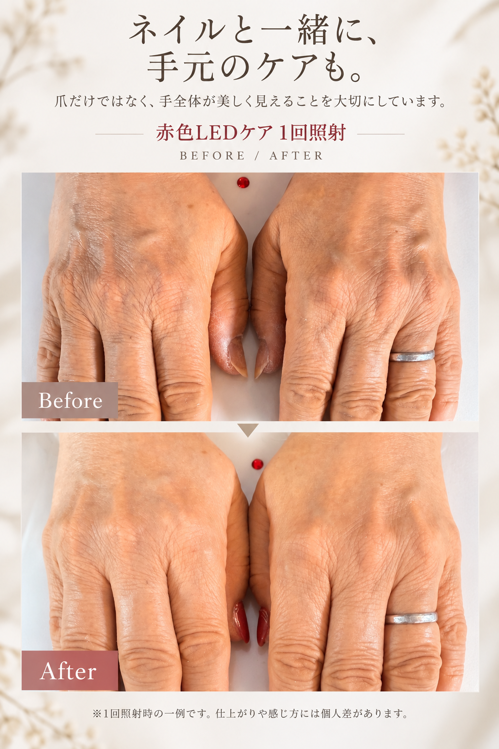 赤色LEDケア Before After